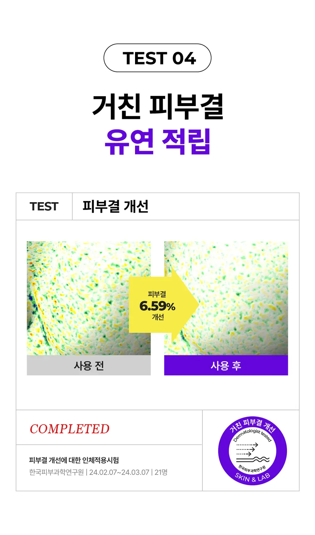 [올영단독] 스킨앤랩 베리어덤 링거 앰플70ml(+70ml) 더블기획 상세페이지 13